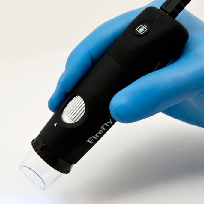 DE300 Digital Dermatoscope