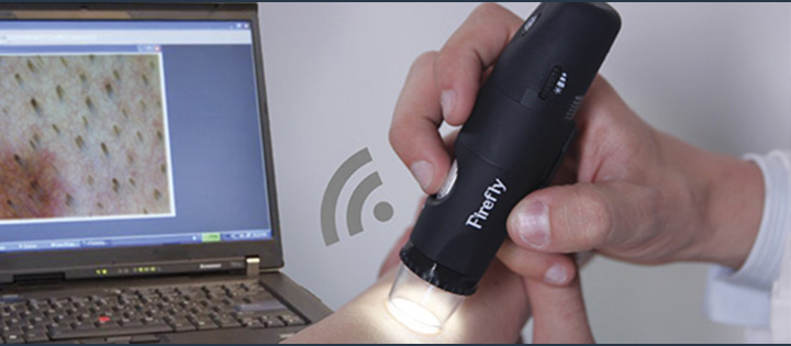 Firefly Dermatoscope